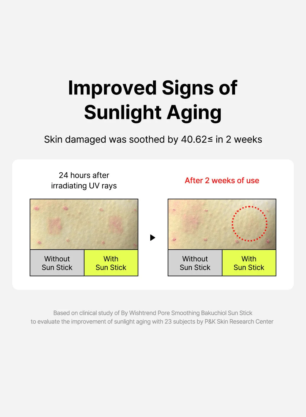 Pore Smoothing Bakuchiol Sun Stick (18g) - Image 10